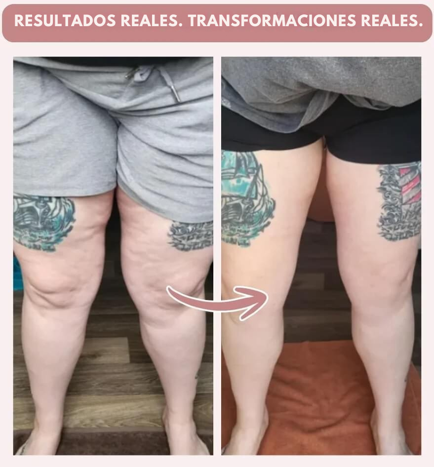 Leggings 3D anticelulíticos