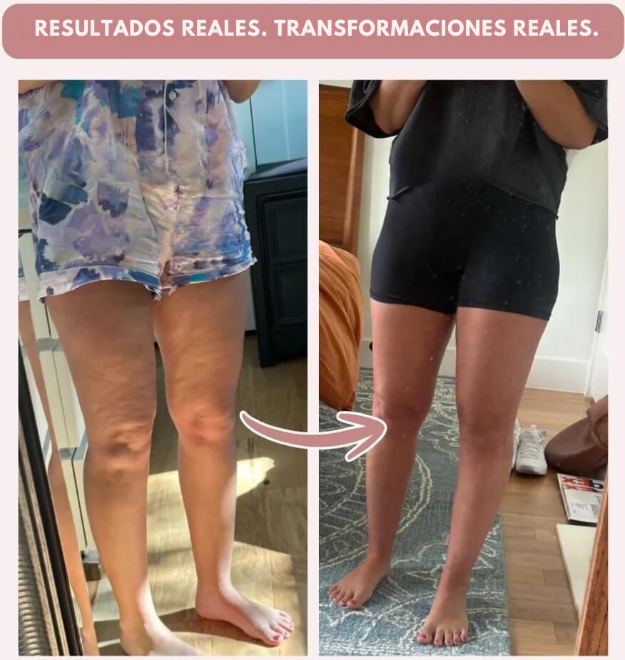 Leggings 3D anticelulíticos